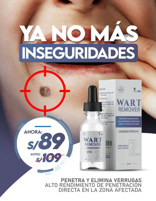 quita verrugas
